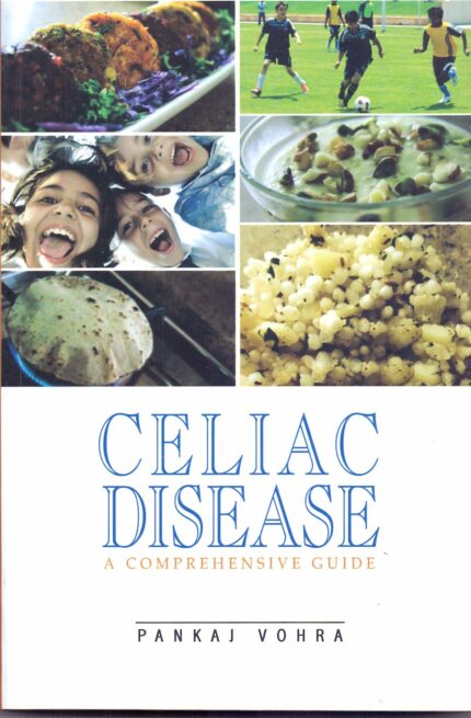 CELIAC DISEASE:A COMPREHENSIVE GUIDE